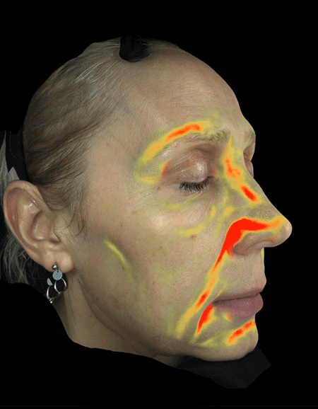 D9衰老权重排行占比